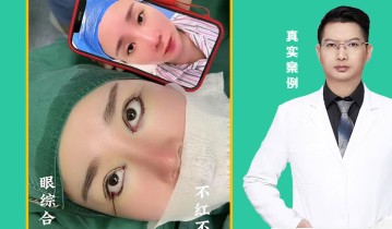 眼综合四项